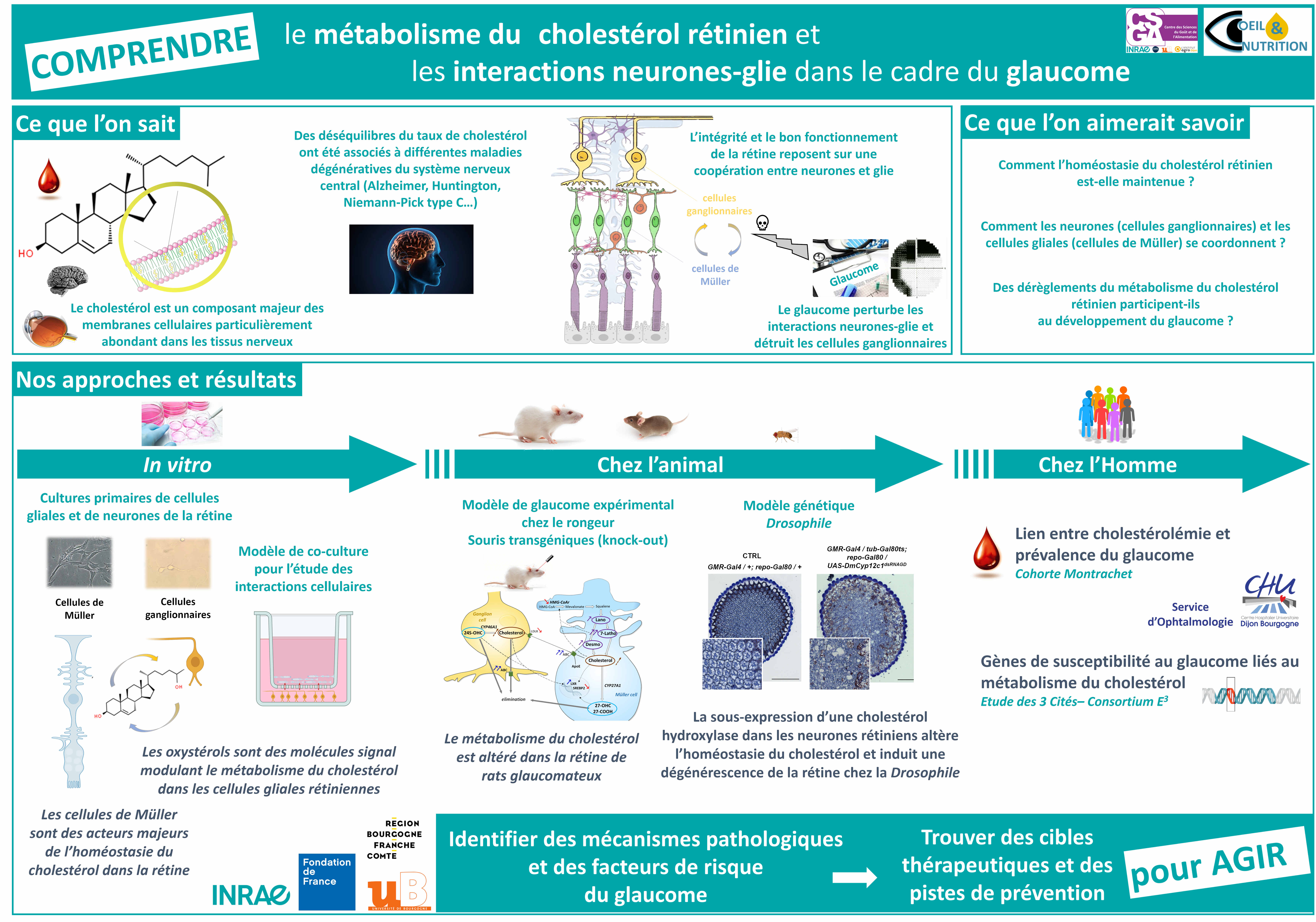 chol-glaucome-FR.jpg